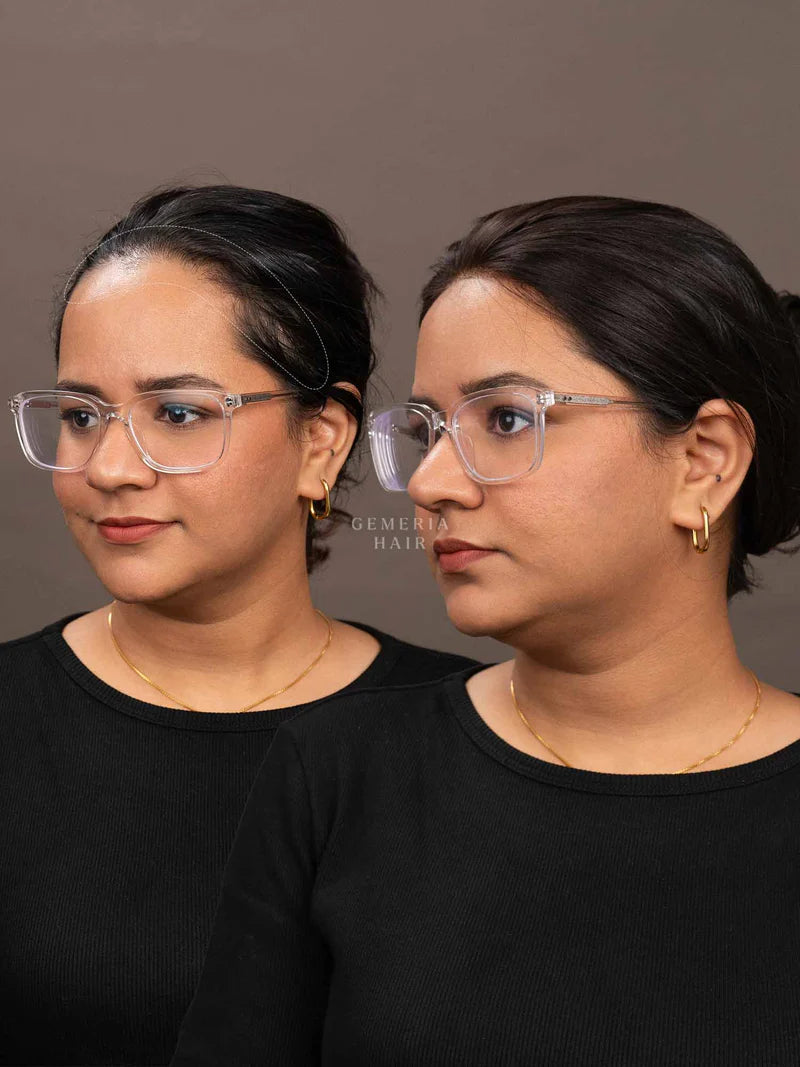 Front Hairline Topper for Receding Hairline