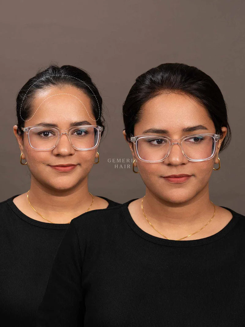 Front Hairline Topper for Receding Hairline